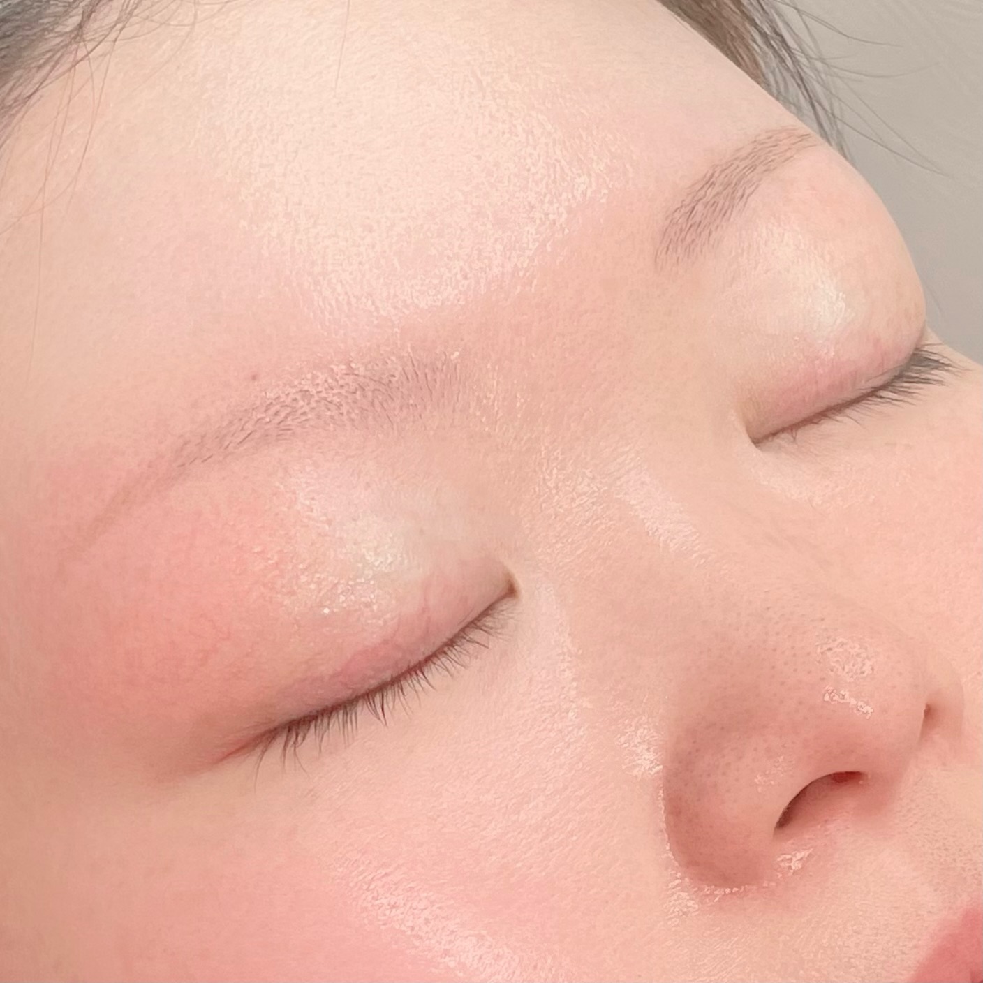 before画像