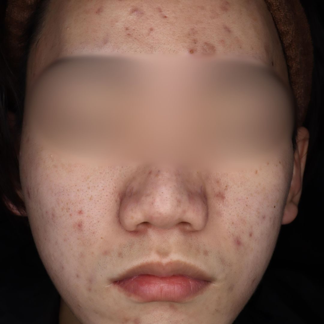 before画像