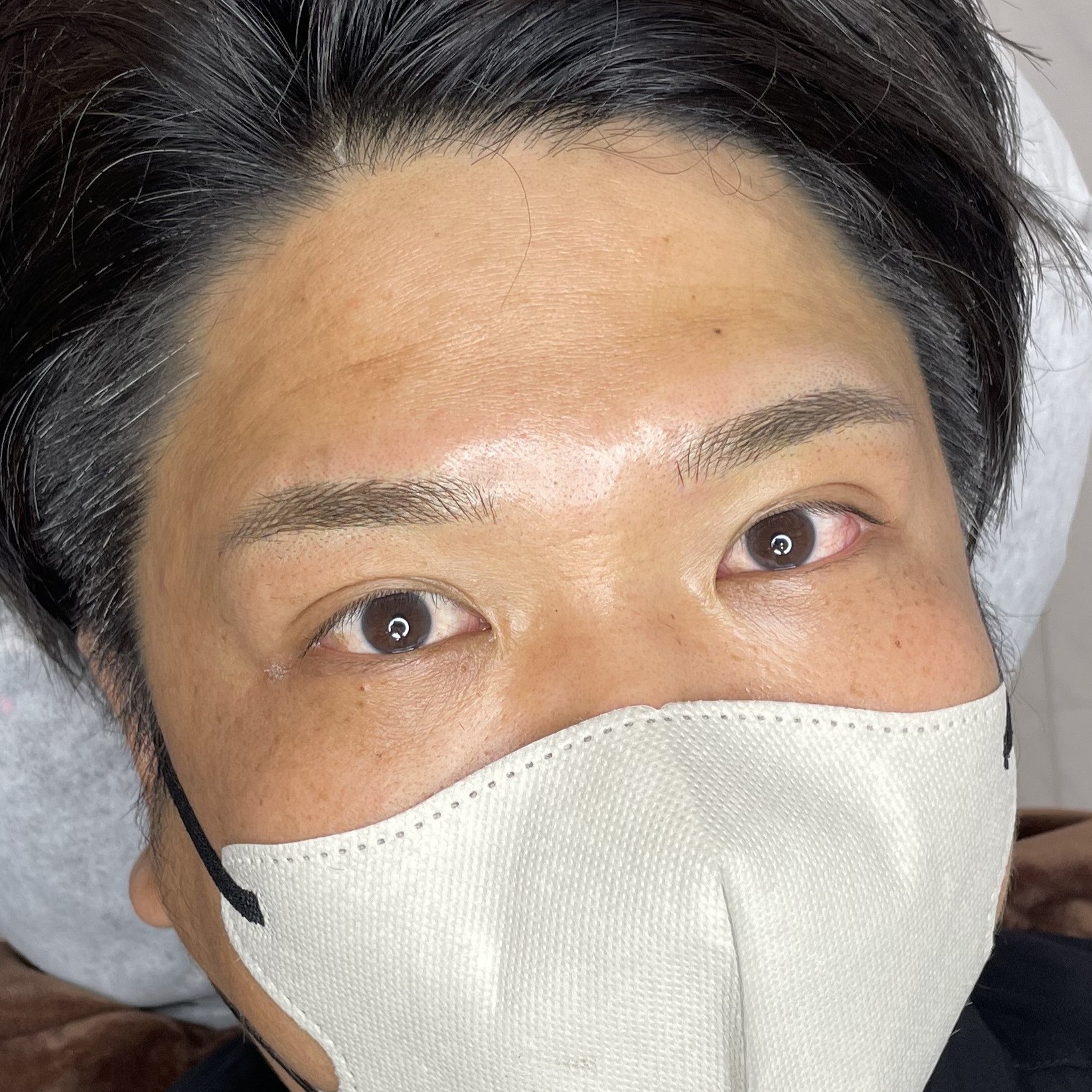 after画像