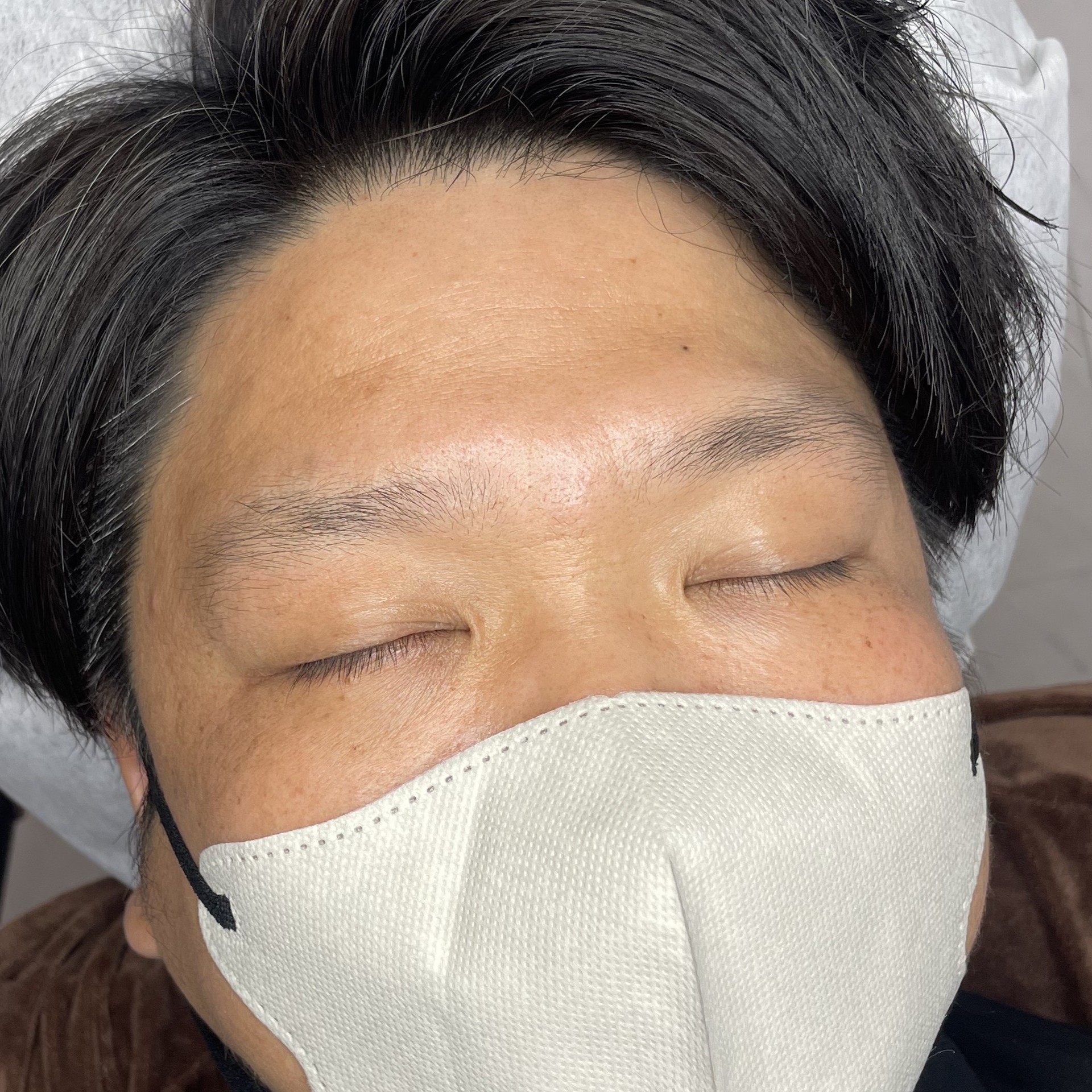 before画像