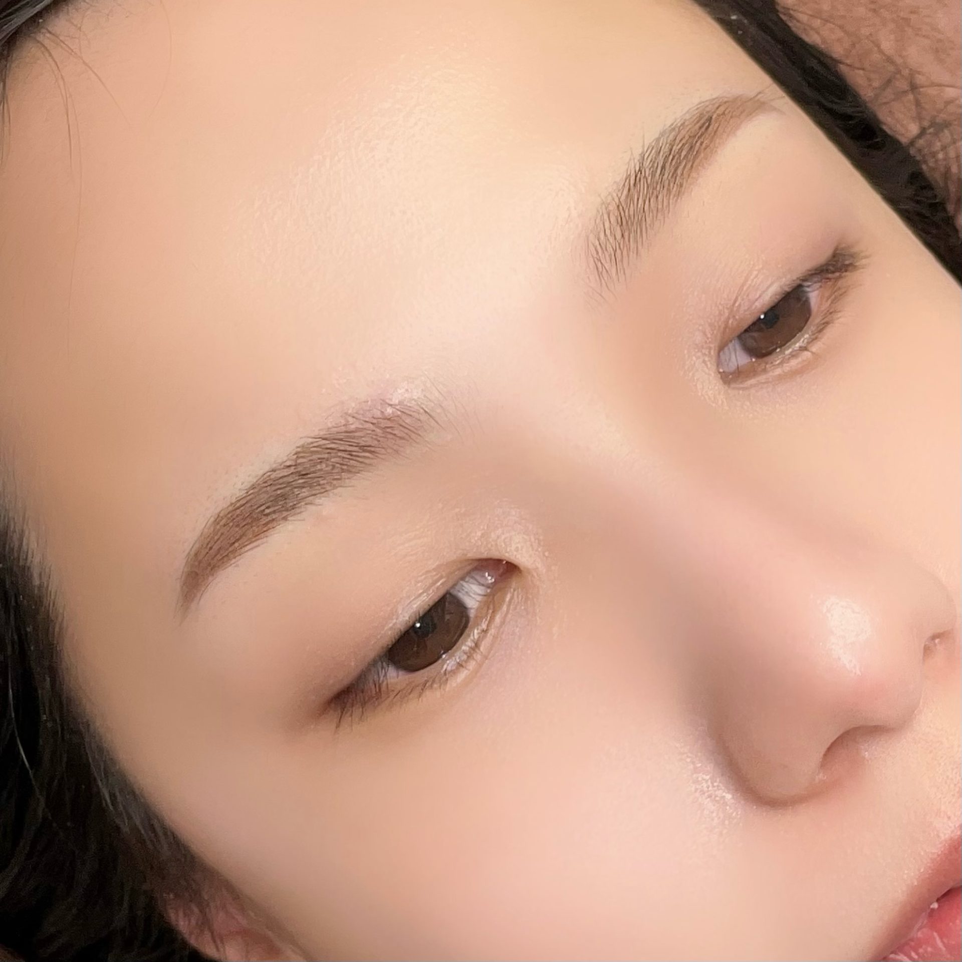 after画像